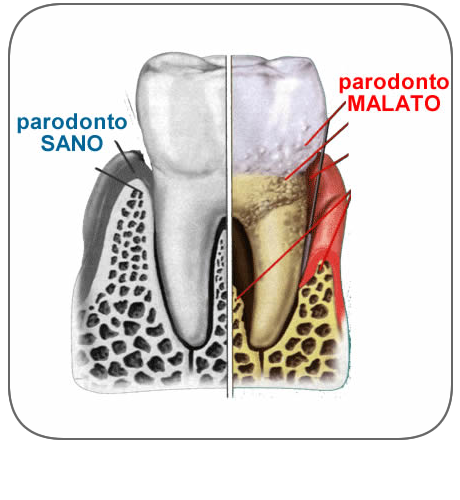 Parodontologia
